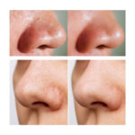 شوینده صورت کنترل منافذ آنوا Anua مدل Cleansing Oil(200 میل) - Image 3