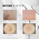 سرم میکرو نیدلینگ ریدل شات وی تی 100 REEDLE SHOT VT - Image 8